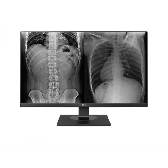 LG Clinical Review Monitor
